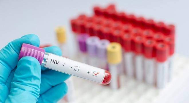 Aumenta el número de notificaciones de casos de VIH en ES