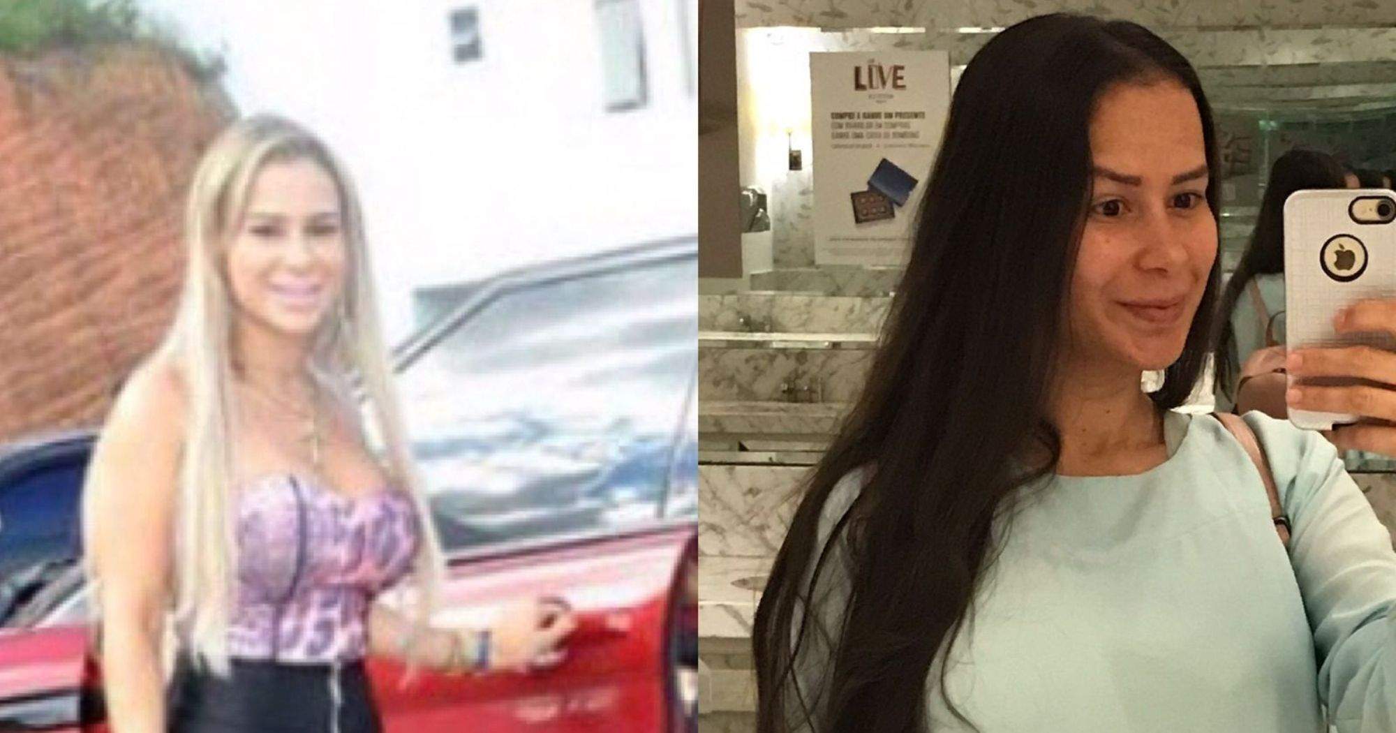 Ex Prostituta De Luxo Do Es Faz Vaquinha Para Tirar Silicone Sinto Dor