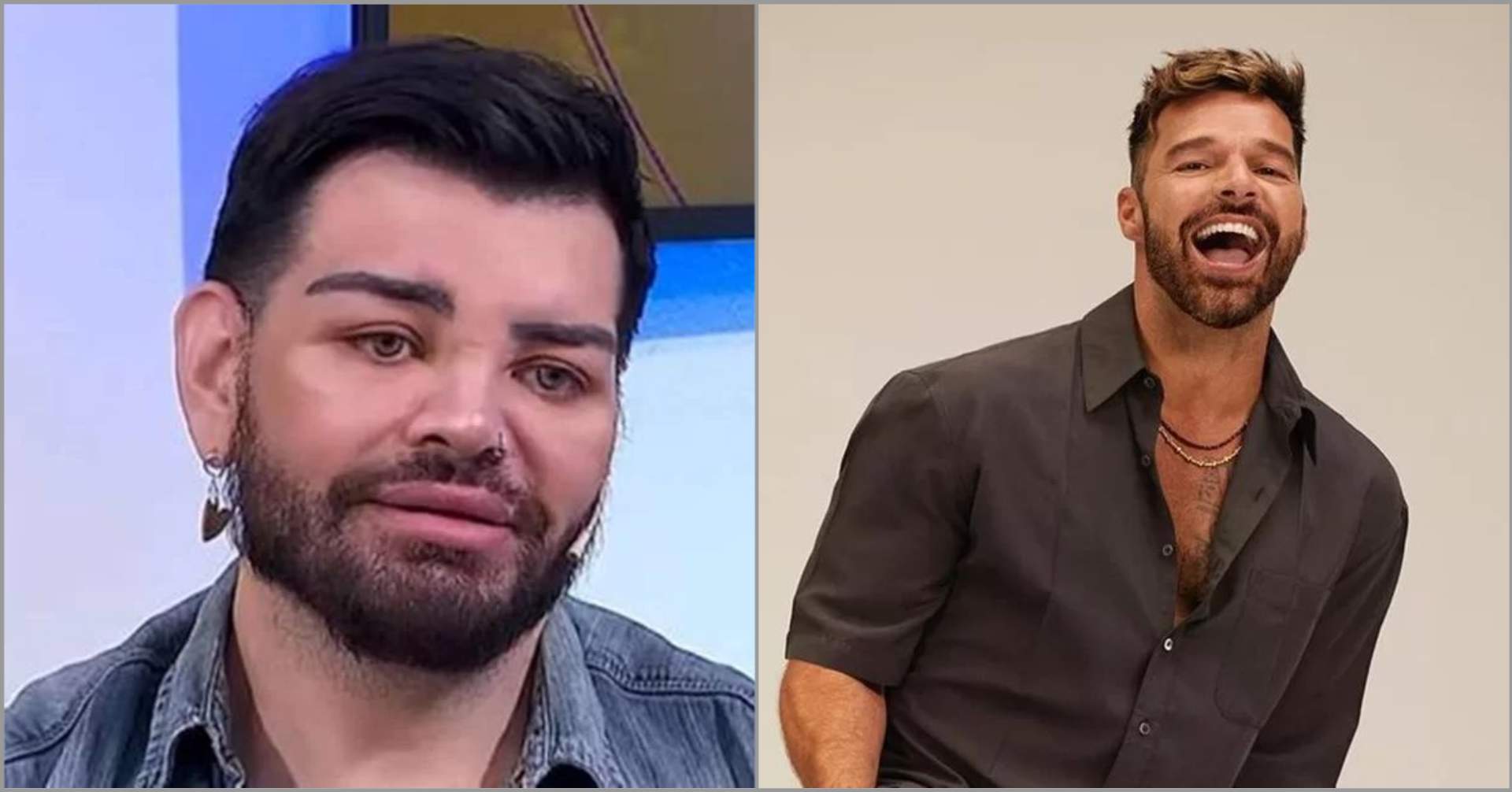El actor argentino tiene que someterse a más de 30 operaciones para parecerse a Ricky Martin y casi pierde la visión