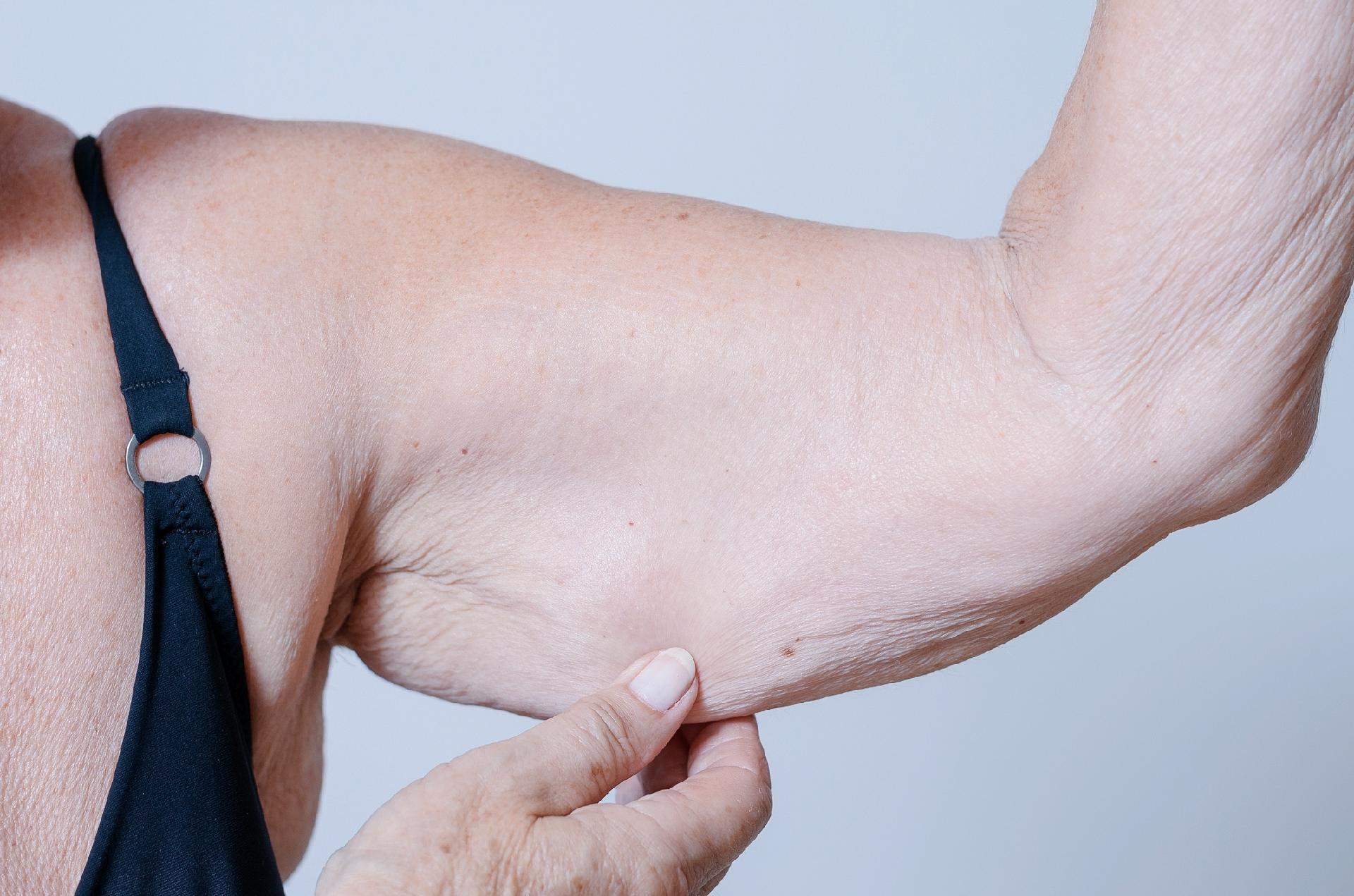 Qual doença faz perder massa muscular?